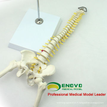 SPINE08 12381 affichage médical de Tableau d&#39;éducation de squelette flexible de colonne vertébrale de modèle d&#39;éducation et demi-jambe